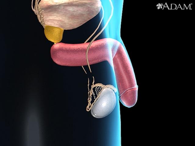 Sit Down Son: Vasectomy Recovery Isn't Hard, But It is Critical - SpermCheck