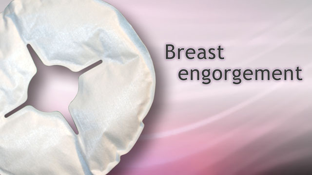 <div class=media-desc><strong>Breast engorgement</strong><p>Breast engorgement can be painful for nuring mothers. Learn the causes of breast engorgement, how to prevent it, and what to do if it happens.</p></div>