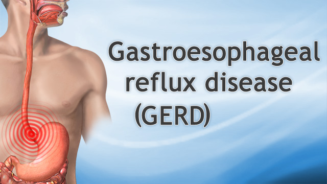 <div class=media-desc><strong>Gastroesophageal reflux disease</strong><p>Do you feel a burning in your chest not long after you eat or lie down? Well, if so, you may have Gastroesophageal reflux disease, or GERD, for short. Hi, I'm Dr. Hecht talking today about GERD.When we swallow food, it normally travels down our food pipe, or esophagus, into the stomach, where it's greeted by a rush of Hydrochloric acid secreted by specialized cells that line the stomach. This acid is so powerful, it could actually eat the paint right off your car.Fortunately, there's a band of muscle between the stomach and the esophagus called the Lower Esophageal Sphincter or L-E-S, for short, that clamps down to prevent acid from moving or refluxing upward and burning the lining of the esophagus. If that band of muscle does not adequately clamp down, it allows foods, liquids and strong stomach acid to leak back up into your esophagus causing irritation and burning that's known as heartburn or GERD. Maintaining good, tight L-E-S muscle tone is really the key to preventing heartburn, or GERD. It's as simple as that.So what causes GERD? Well, here are some things that'll cause L-E-S tone to relax and cause GERD. Being overweight or obese, smoking, and drinking too much alcohol can cause GERD. Chocolate and peppermint can cause GERD. This includes eating rich desserts and those mints that you get on the way out of many restaurants. If you’re a woman, pregnancy can bring on GERD.To determine if you have GERD, your doctor may request an upper endoscopy to look inside your esophagus and stomach to diagnose reflux, or look for any damage caused by reflux. Other tests can measure the acid in your esophagus, the amount of pressure in your esophagus, or if you have blood in your stool caused by the irritation in your esophagus.If you do have GERD, lifestyle changes can go a long way to help manage your symptoms. First off, avoid foods that cause problems for you, and don’t drink alcohol. Avoid eating large meals. If you’re a little heavy, try to lose some weight. Even 10 pounds of weight loss will cut down on GERD. And if you smoke, try to stop smoking.If you continue to have GERD symptoms, you should see a Gastroenterologist for evaluation and have an upper endoscopy exam. Your doctor may request you take over-the-counter antacids, or he may prescribe a prescription for stronger medication.You should call your doctor if you’re bleeding, feel like you’re choking, get filled up quickly when you eat, have trouble swallowing, throw up often or experience sudden weight loss.The good news is that most people who have GERD don’t need surgery. For the worst of cases, surgeons may perform a laparoscopic procedure to tighten a weak L-E-S muscle.If you have occasional acid reflux, acid blockers and antacid tablets can be used on an as needed basis. However, if you're having acid reflux symptoms more than 3-4 times a week, it's recommended to take prescribed medications every day to prevent repeated tissue damage to the esophagus.</p></div>