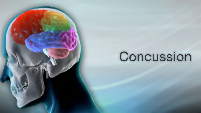 <div class=media-desc><strong>Concussion</strong><p>A pretty good bump on the head, or a violent collision, can leave you feeling woozy and confused, and with a splitting headache. If it's bad enough, you may even lose consciousness. So, what causes a concussion? Your brain is a delicate organ encased in bone, your skull. When you fall down, suffer violent contact during a sports activity, or hit your head in a car accident, your brain moves but has nowhere to go. Instead, it swirls around inside your head and bumps into your skull. This causes bruising that damages your brain. The classic symptom of a concussion is loss of consciousness. But many people might experience only a brief moment of amnesia or disorientation. Typically, you'll have a headache, feel sleepy, and you may even vomit. Most likely you will not be able to think straight, that is, maybe you can't remember the date or your name. You may see flashing lights and even feel like you've lost time. Sometimes, it may take a day or two after the blow for some symptoms to develop. Your doctor will do a physical exam, checking your pupils, your ability to think, your coordination, and your reflexes. The doctor may want to look for bleeding in your brain, so you may need a CT or MRI scan. You may also have a brain wave test, or EEG. So, how do we treat a concussion? First and foremost, you will need to rest and be watched -- sometimes in the hospital, and sometimes by a parent, friend, or spouse if you're at home. For your headache, you can take acetaminophen. You may need to eat a light diet for a while if you continue to feel sick, or feel like vomiting. You'll want to have someone stay with you for the first 12 to 24 hours after your concussion. It's okay to sleep, but someone should wake you up every few hours and ask you a simple question, such as your name, and then watch you for changes in how you look or act. Obviously, if you were playing sports when you received a concussion, you most likely will need to stop. Sometimes you can't return to a sport for weeks, or longer, especially if your symptoms don't improve. That's because once you've had a concussion, it's easier to get another one, and multiple concussions can lead to long-term brain damage.</p></div>