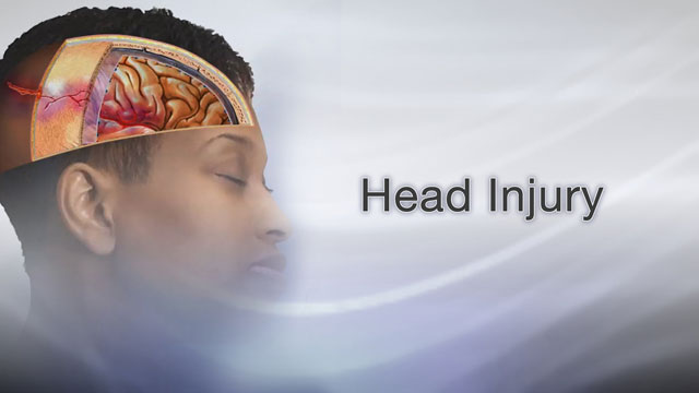 <div class=media-desc><strong>Head injury</strong><p>You've fallen and hit your head. It hurts a little, but you're not bleeding and you feel okay. Do you have a head injury, or are you fine? Knowing how to tell a minor head injury from a serious one could literally save your life. Let's talk about head injuries. Millions of people get head injuries every year. They get into car accidents or fights, they fall, or they get hit in the head while playing sports or working on the job. Most head injuries are minor, because your head comes equipped with its own natural hard hat, a protective skull that surrounds and protects your brain. But sometimes that protection isn't enough. More than a half-million people each year get head injuries severe enough to send them to the hospital. The most common type of head injury is a concussion. That's when a hit in the head makes your brain jiggle around in your skull. You can also get a bruise on your brain, called a contusion. Brain contusions are a lot more serious than bruises from a bump on the arm or leg. Other types of head injuries include a fractured skull or a cut on your scalp. If you get hit in the head or fall and you don't bleed, you've got a closed head injury. If an object enters your brain, like glass from a windshield during a car accident or a bullet from a gunshot, then you have an open head injury. It can be very hard to tell if you've got a minor closed head injury or a serious one. Your head might look perfectly fine from the outside, when you actually have bleeding or swelling inside your brain. To tell the difference, look for other signs of a serious head injury, such as a severe headache; Clear or bloody fluid coming from your nose, ears, or mouth; Confusion, drowsiness, or a loss of consciousness; Changes in the way you hear, see, taste, or smell; memory loss; mood changes or strange behaviors; slurred speech or recurrent vomiting. If you or someone else has any of these symptoms, call for medical help right away. If you don't have these symptoms and you think it's just a minor head injury, you probably don't need to be treated. Just ask a friend or family member to keep an eye on you. If it's your child or someone else with the head injury, wake them up from sleep every 2 or 3 hours to ask questions like, Where are you? and What's your name? just to make sure they're alert. If you're in any doubt about whether a head injury is serious, play it safe and get medical help. To play it even safer, protect your head during any activities that could lead to an injury. Wear a helmet whenever you skateboard, roller skate, ski, snowboard, or ride a bike or motorcycle. Put on your seatbelt whenever you're in the car. And put kids in an age-appropriate car seat or booster seat.</p></div>