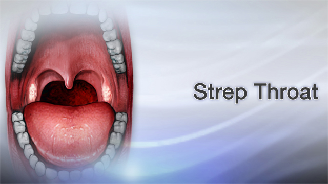 streptococcal pharyngitis bacteria shape