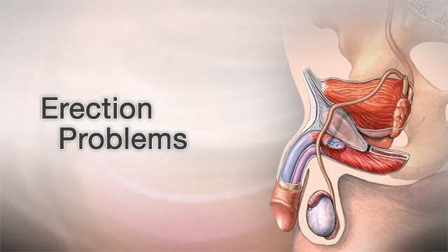 Erection Erectile dysfunction