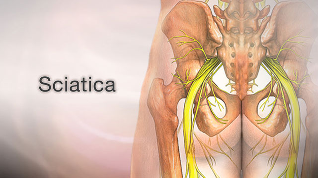 Sciatica - Step 4 - Breathing the right side of the belly - One Minute  Practice