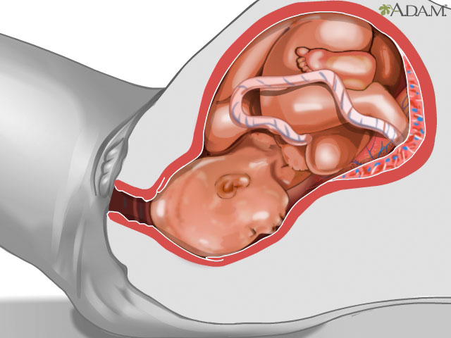 <div class=media-desc><strong>Parto vaginal</strong><p>Cuando el cuello uterino se dilata hasta 10 centímetros, empieza la fase de pujo y expulsión del trabajo de parto. 

Durante esta fase, el bebé inicia su viaje a través del canal del parto. A medida que la cabeza del bebé rota, puede deformarse mientras avanza lentamente por este canal angosto. Los huesos del cráneo del bebé poseen aberturas llamadas fontanelas, que permiten que su cabeza se alargue y amolde al canal del parto. 

A medida que la cabeza del bebé es expulsada, ésta girará naturalmente hacia un lado. Se sujetan la cabeza y los hombros del bebé, y el resto de su cuerpo generalmente sale bastante rápido.

A menudo, cuando los padres ven al recién nacido, se dan cuenta de que tanto el dolor como la espera valieron la pena. 

¡Bienvenido al mundo, pequeñín!</p></div>
