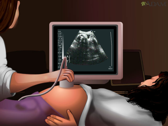 Spanish HIE Multimedia - Ecografía en el embarazo