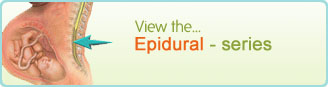 Epidural - Serie