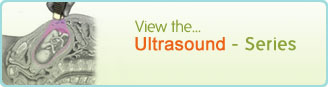 Ultrasound - Series
