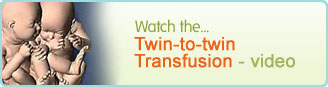 Twin-to-twin transfusion syndrome