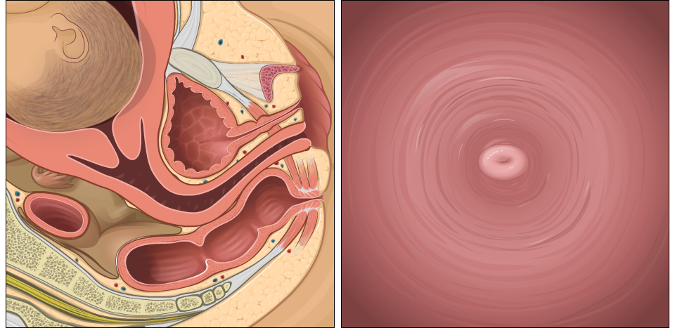 Cervical Dilation Interactive Tool Pregnancy Health Center Health Information St Luke S Hospital