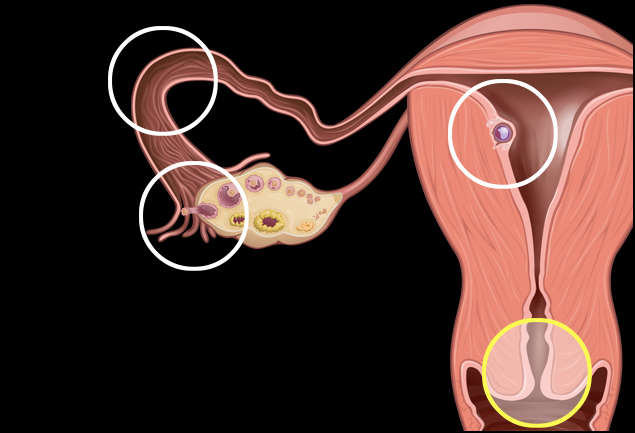 Conception Image