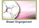 breastengorgement