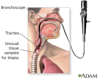 Upper airway test - Illustration Thumbnail
                      