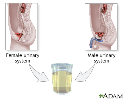 Urine test - Illustration Thumbnail              