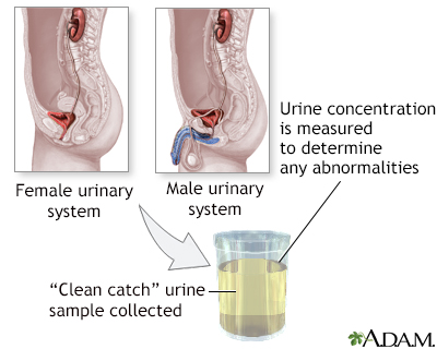 concentrated urine