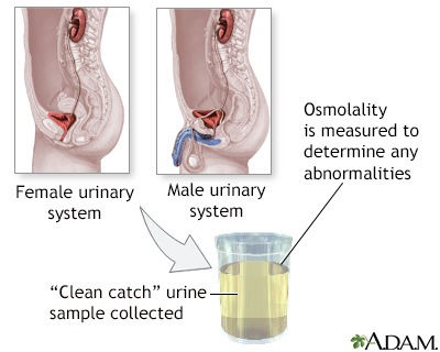 Urine osmolality normal range