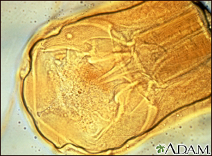 Hookworm - close-up of the organism