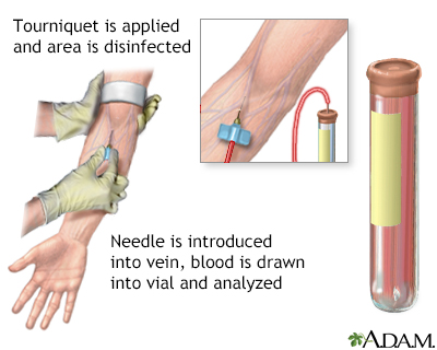 Blood test - Illustration Thumbnail              