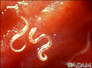 Hookworm - Ancylostoma caninum