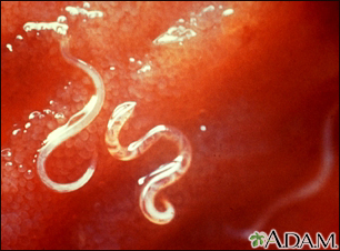 hookworm in humans