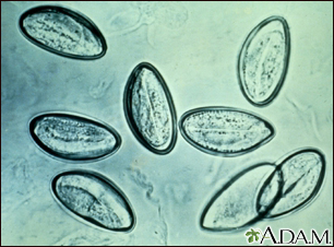 Pinworm eggs - Illustration Thumbnail
              