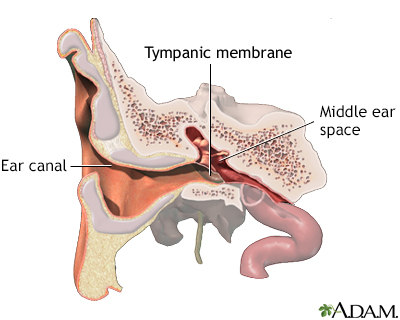 normal tympanic membrane labeled