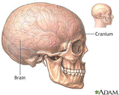 Brain Surgery Information Mount Sinai New York