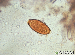 Trichuris trichiura egg - Illustration Thumbnail
              