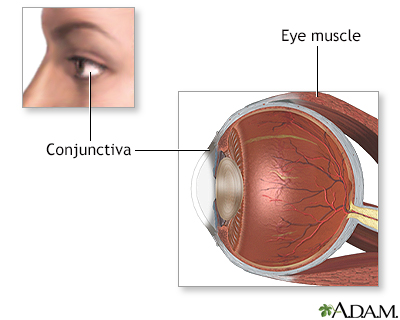 Eye muscle repair - normal anatomy - Presentation Thumbnail
                    