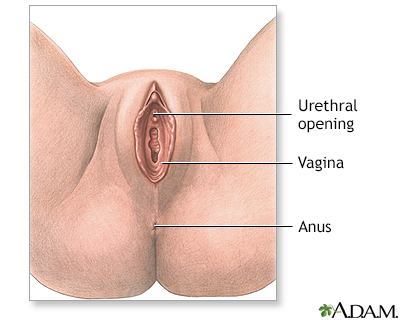 Anterior vaginal wall repair (surgical treatment of urinary incontinence) - series - Illustration Thumbnail
              