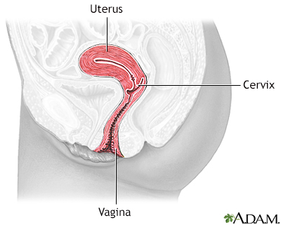 Cervical dysplasia  - series - Illustration Thumbnail
              