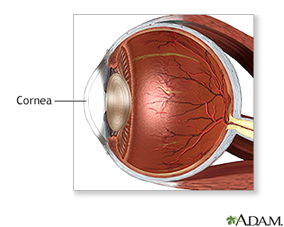 Corneal transplant - normal anatomy - Presentation Thumbnail              