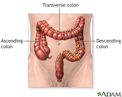 Large bowel resection - series - Presentation Thumbnail
              