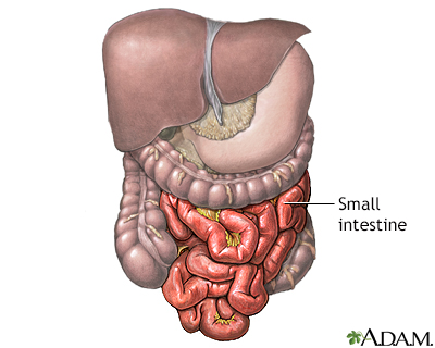 Meckel's diverticulectomy - normal anatomy - Presentation Thumbnail              