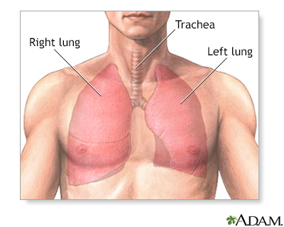 lung surgery for collapsed lung