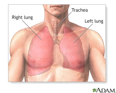 Pulmonary lobectomy - series - Normal anatomy - Presentation Thumbnail              