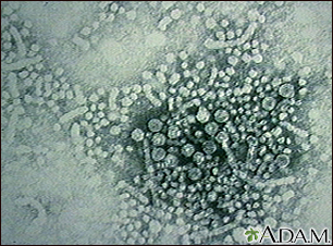 Hepatitis B virus - Illustration Thumbnail
                      