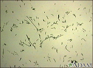 Campylobacter jejuni organism - Illustration Thumbnail
              