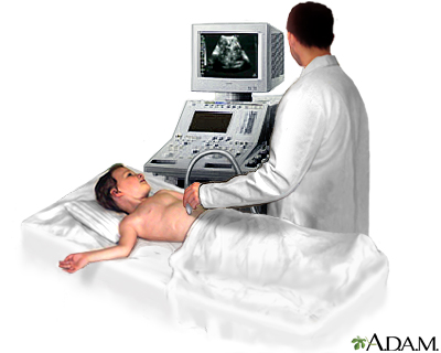 Abdominal ultrasound - Illustration Thumbnail
              