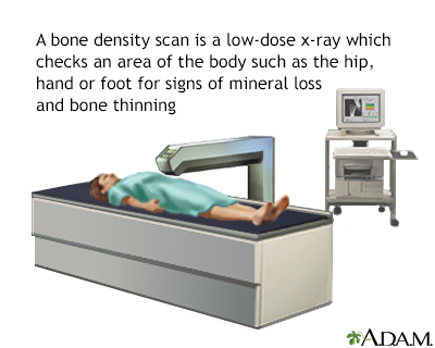 DEXA Scan: What It Is and Why It's Done