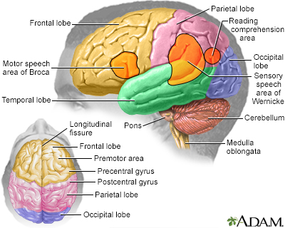 grand mal seizure mri