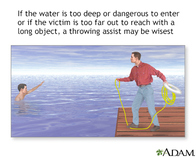 Drowning rescue, throw assist - Illustration Thumbnail
              