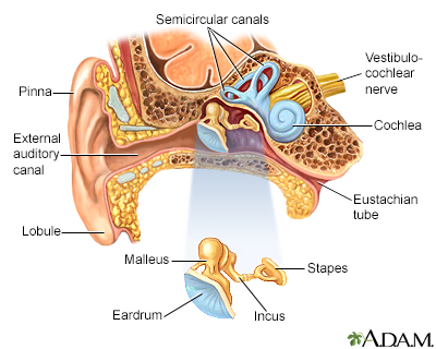 burst eardrum