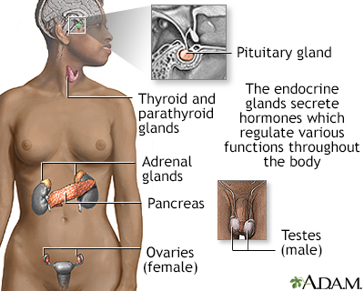 gigantism in children symptoms