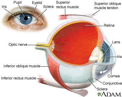 Coloboma of the iris Information