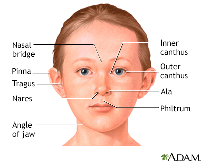 smooth philtrum