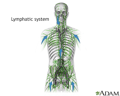 location of lymph nodes lymphoma