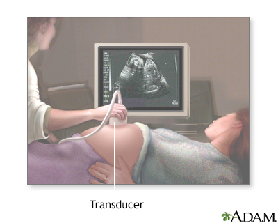 Ultrasound in pregnancy - Illustration Thumbnail
                      