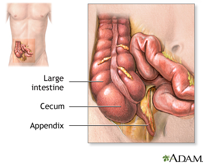 Pain in Lower Right Abdomen - causes and symptoms 