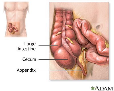 Point tenderness - abdomen Information